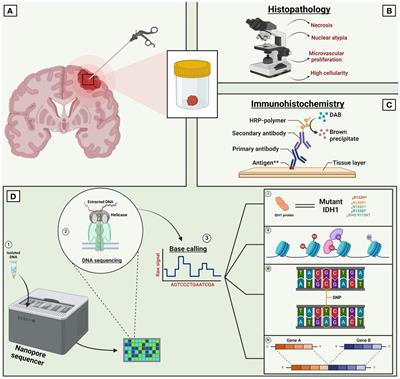 Long-read sequencing for brain tumors